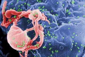 La scansione del virus Hiv (in verde) in gemmazione da una cellula